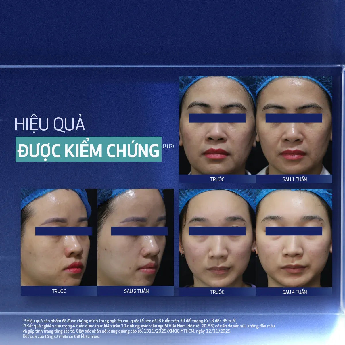 Kem Dưỡng Làm Mới & Duy Trì Độ Tươi Trẻ Làn Da Ban Đêm Obagi Medical Retinol + PHA (50ml)