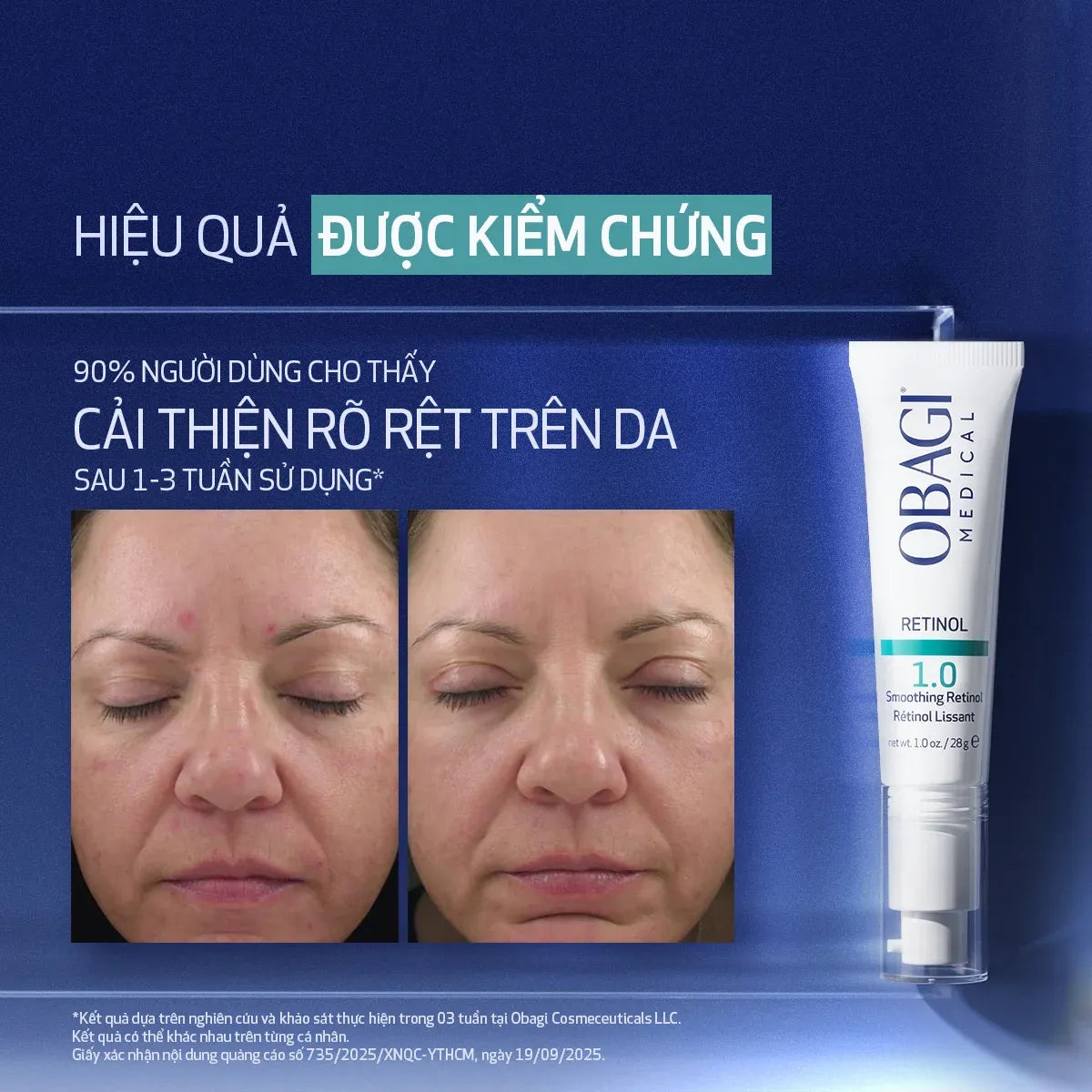 Kem Dưỡng Làm Mờ Nếp Nhăn, Mờ Thâm & Làm Đều Màu Da Obagi360 Retinol 1.0