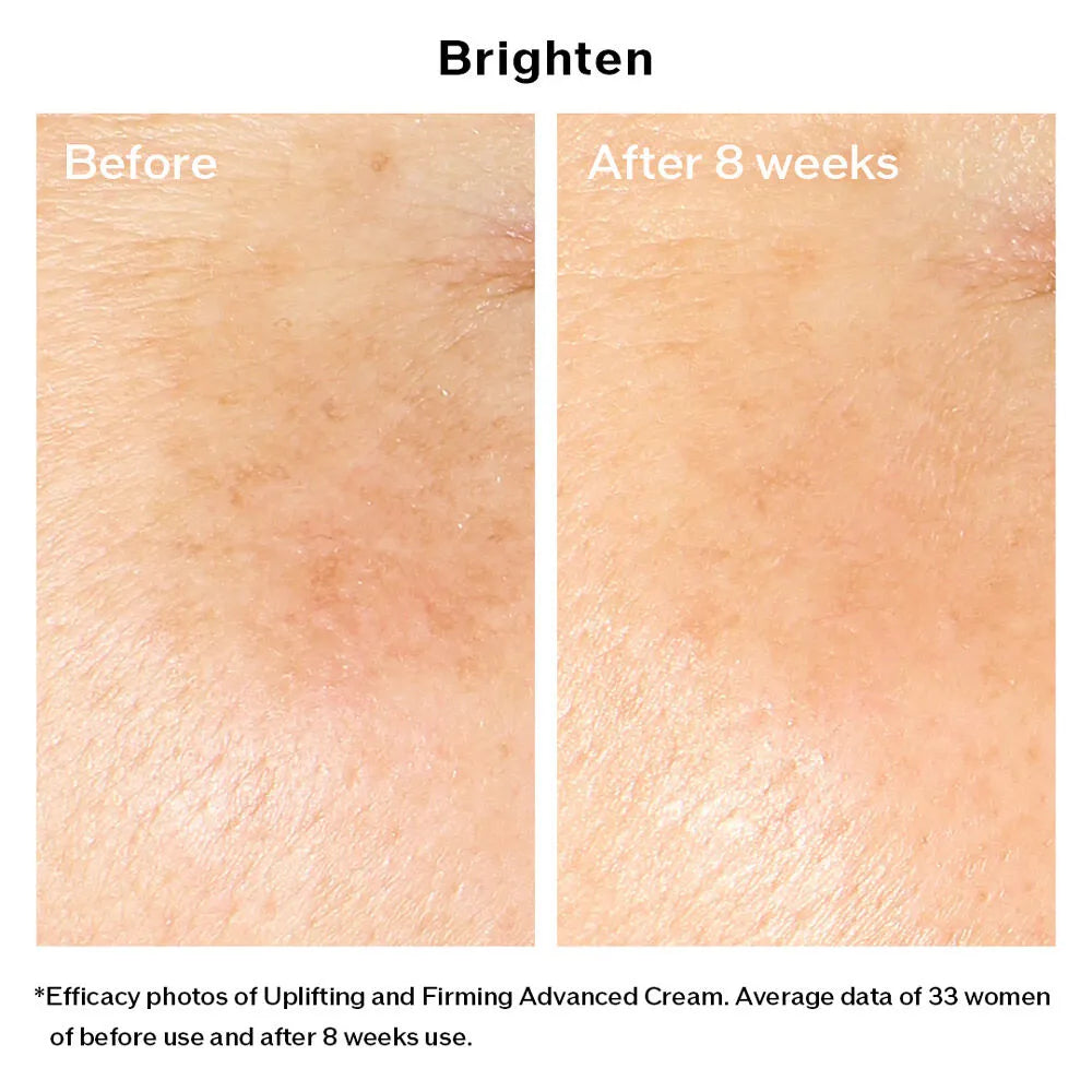 Kem Dưỡng Nâng Cơ Shiseido Vital Perfection Uplifting and Firming Advanced Cream 50ml