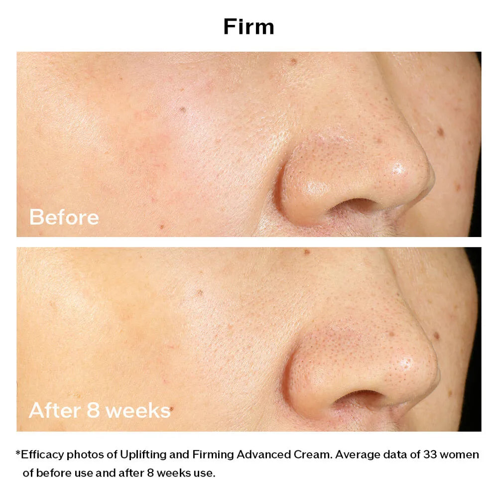 Kem Dưỡng Nâng Cơ Shiseido Vital Perfection Uplifting and Firming Advanced Cream 50ml