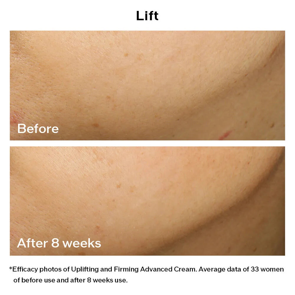 Kem Dưỡng Nâng Cơ Shiseido Vital Perfection Uplifting and Firming Advanced Cream 50ml