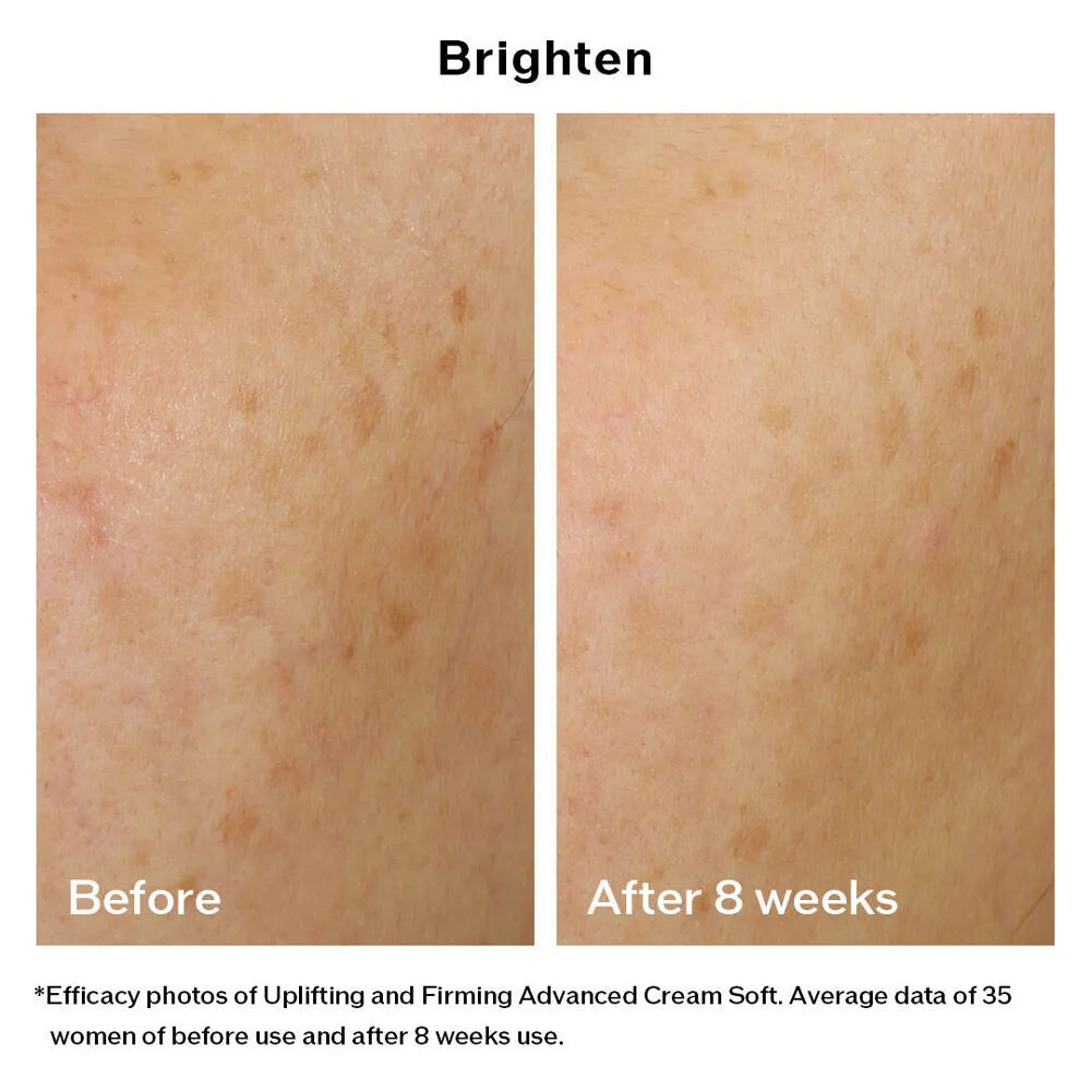 Kem Dưỡng Nâng Cơ Shiseido Vital Perfection Uplifting and Firming Advanced Cream Soft 50ml