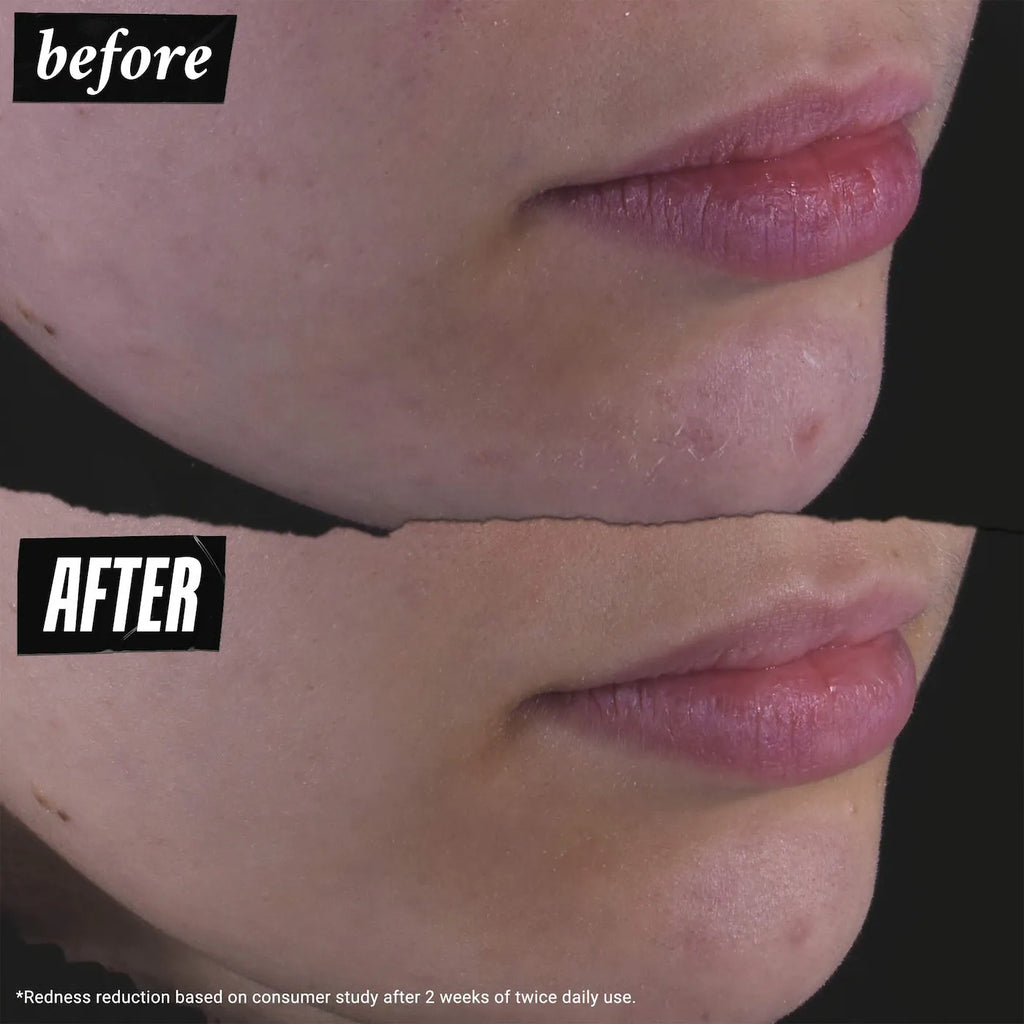 Toner Kiehl's Calendula Herbal Extract
