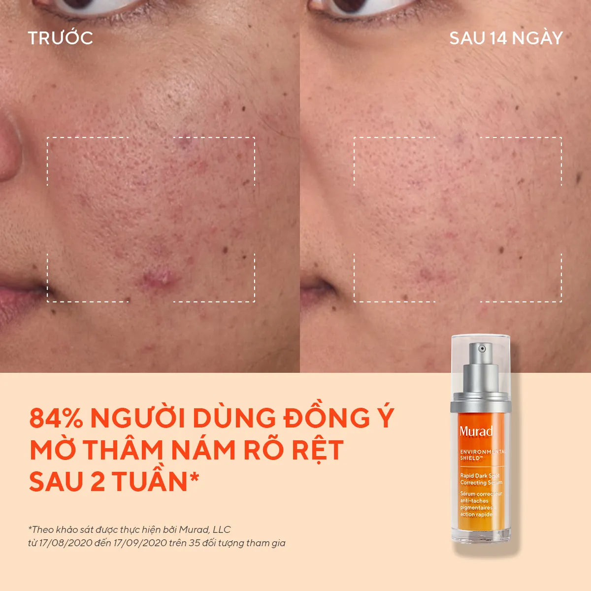 Tinh Chất Làm Mờ Nám & Giảm Đốm Nâu Murad Rapid Dark Spot Correcting Serum 30ml