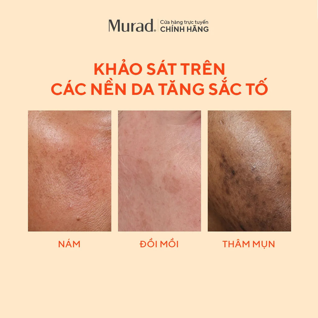 Tinh Chất Làm Mờ Nám & Giảm Đốm Nâu Murad Rapid Dark Spot Correcting Serum 30ml