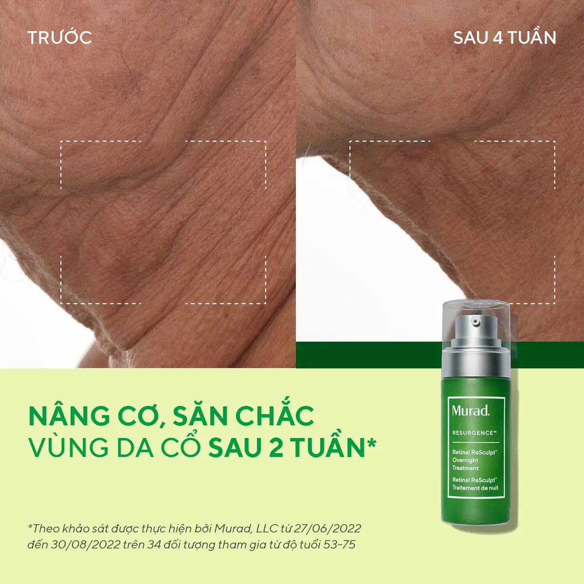 Tinh Chất Retinal Cải Thiện Độ Đàn Hồi Murad Retinal ReSculpt Overnight Treatment 30ml