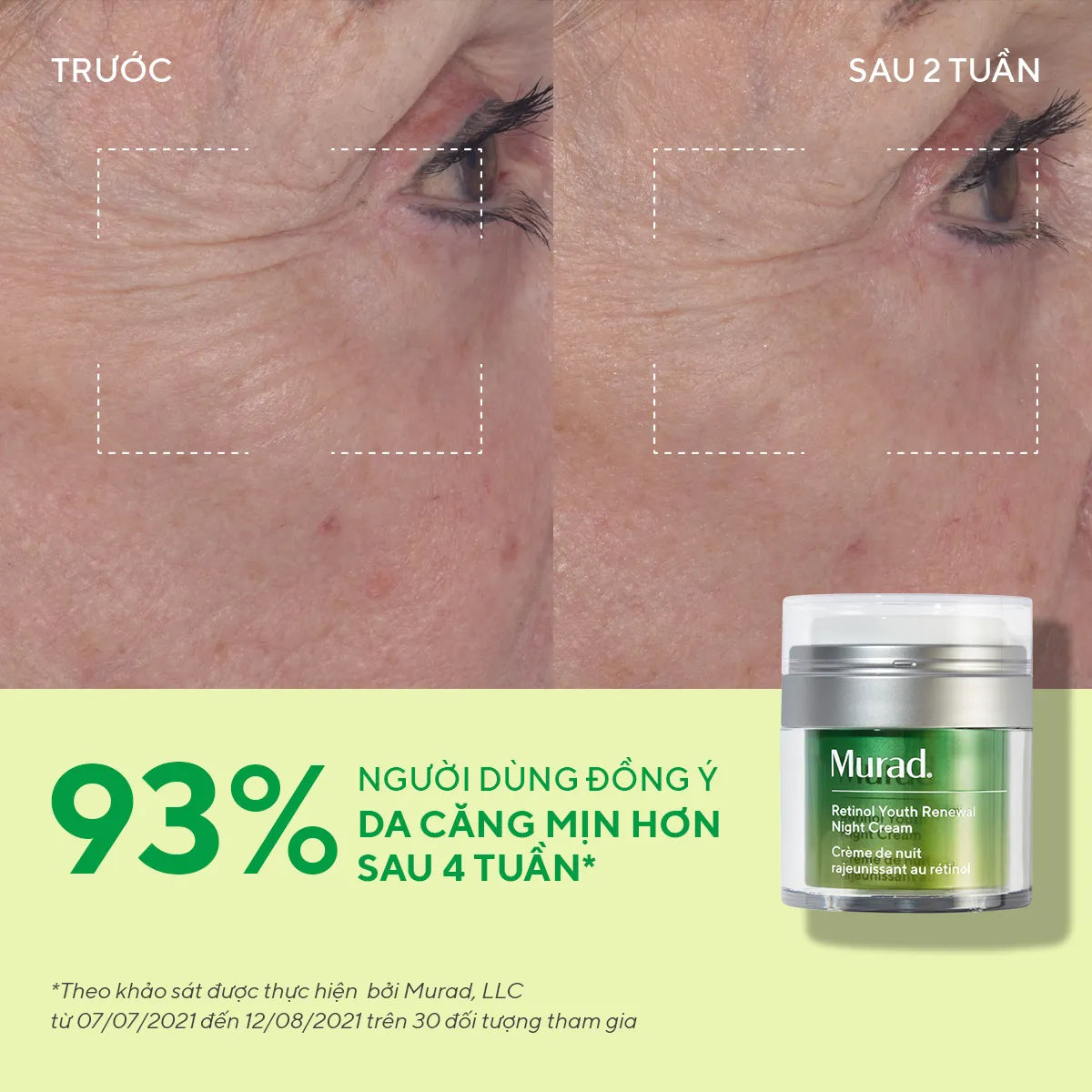 Kem Dưỡng Đêm Retinol Giúp Da Mịn Màng & Mờ Nếp Nhăn Murad Retinol Youth Renewal Night Cream 50ml