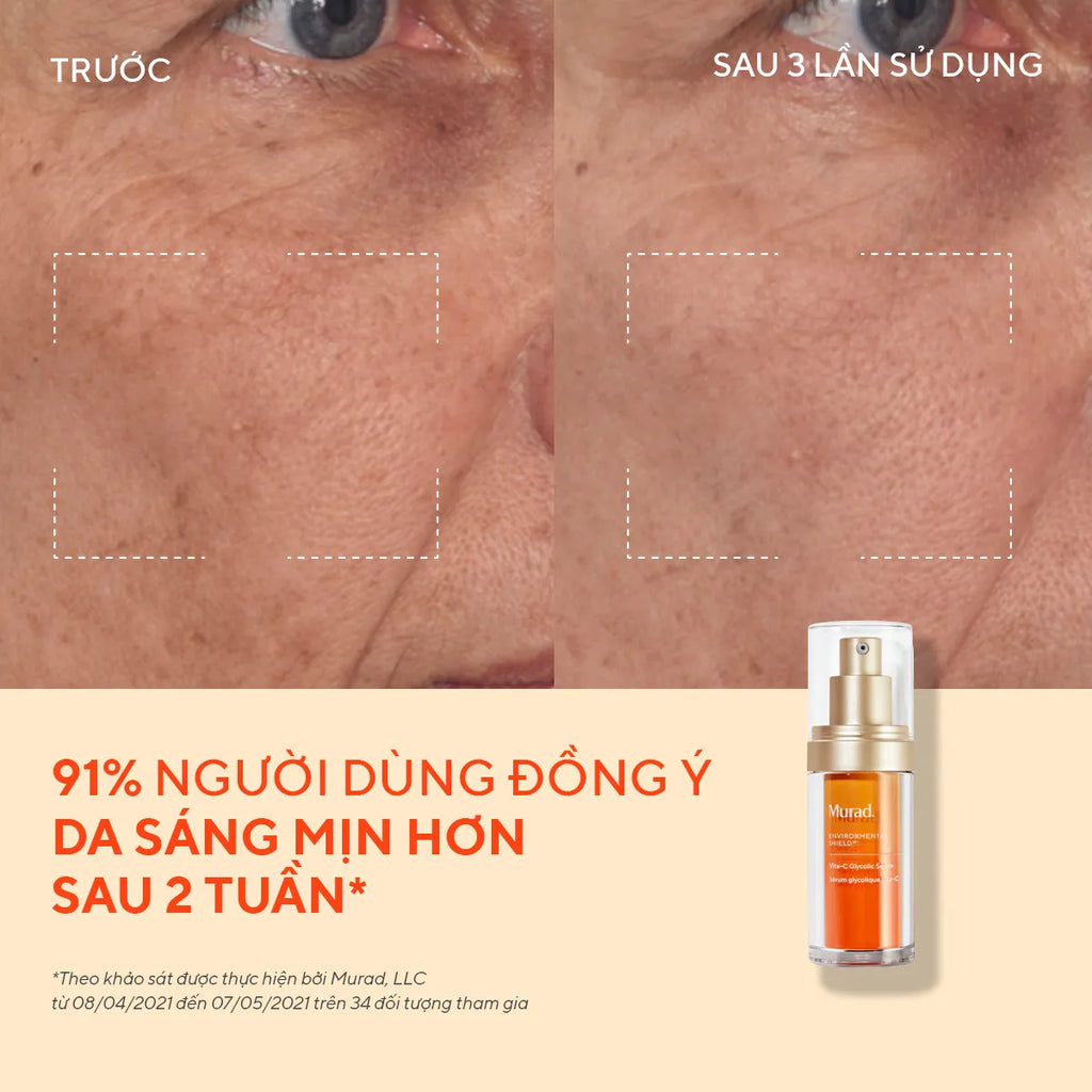 Tinh Chất Hỗ Trợ Sáng Da & Làm Đều Màu Da Murad Vita-C Glycolic Brightening Serum 30ml