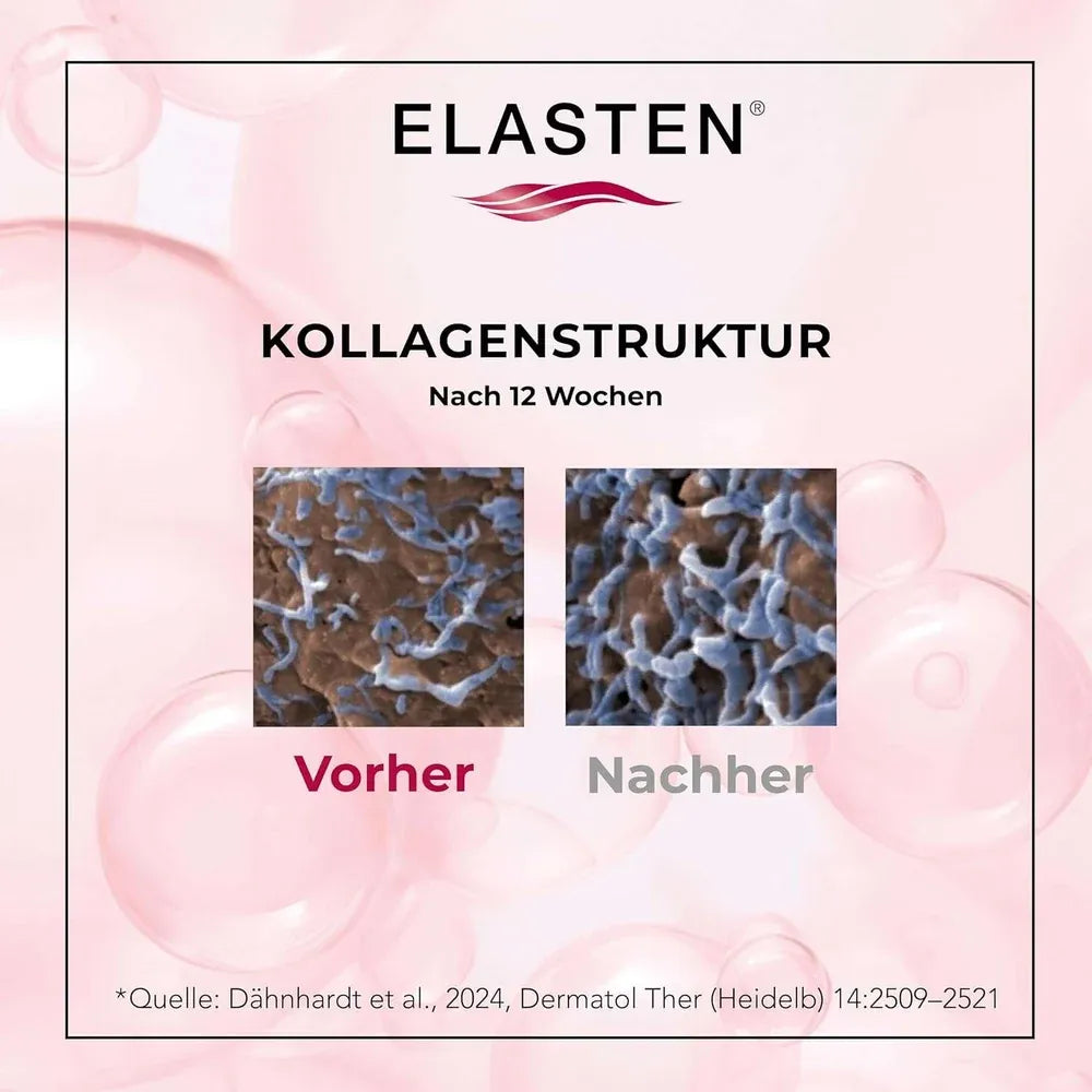 Nước Uống Collagen ELASTEN® Hỗ Trợ Cấp Ẩm, Tăng Độ Săn Chắc & Ngăn Ngừa Lão Hóa Da (Hộp 28 Ống)