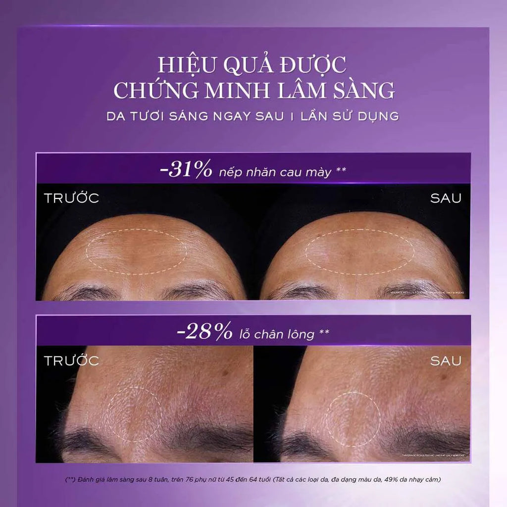 Lancôme Rénergie C.R.x. Triple Serum Retinol 50ml – Tinh Chất Chống Lão Hóa 3 Lõi