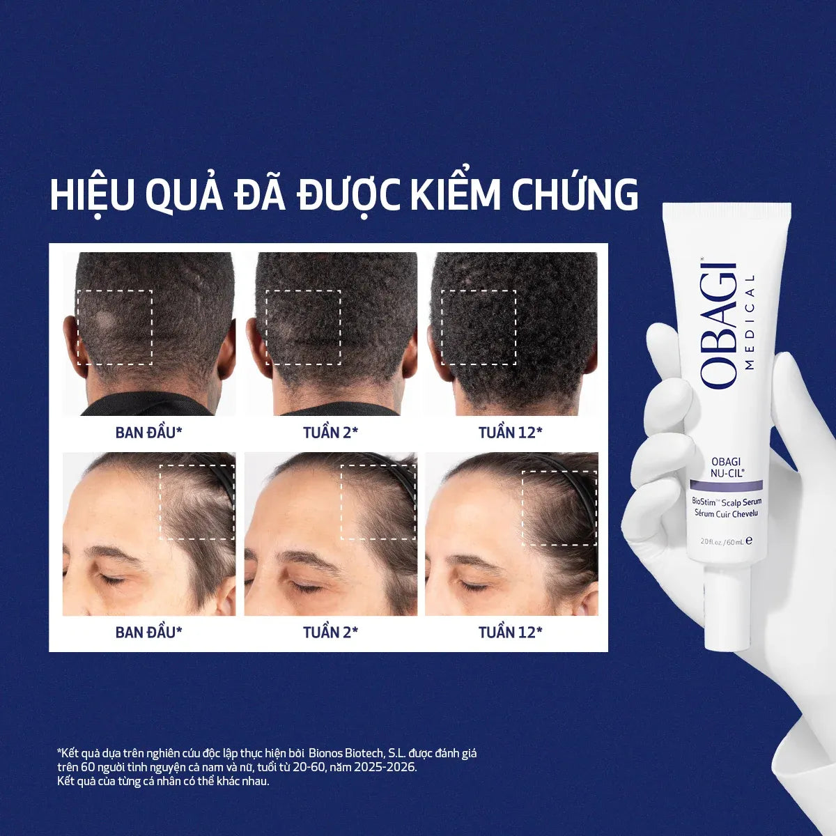 Serum Dưỡng Da Đầu & Nang Tóc OBAGI NU-CIL® BIOSTIM™