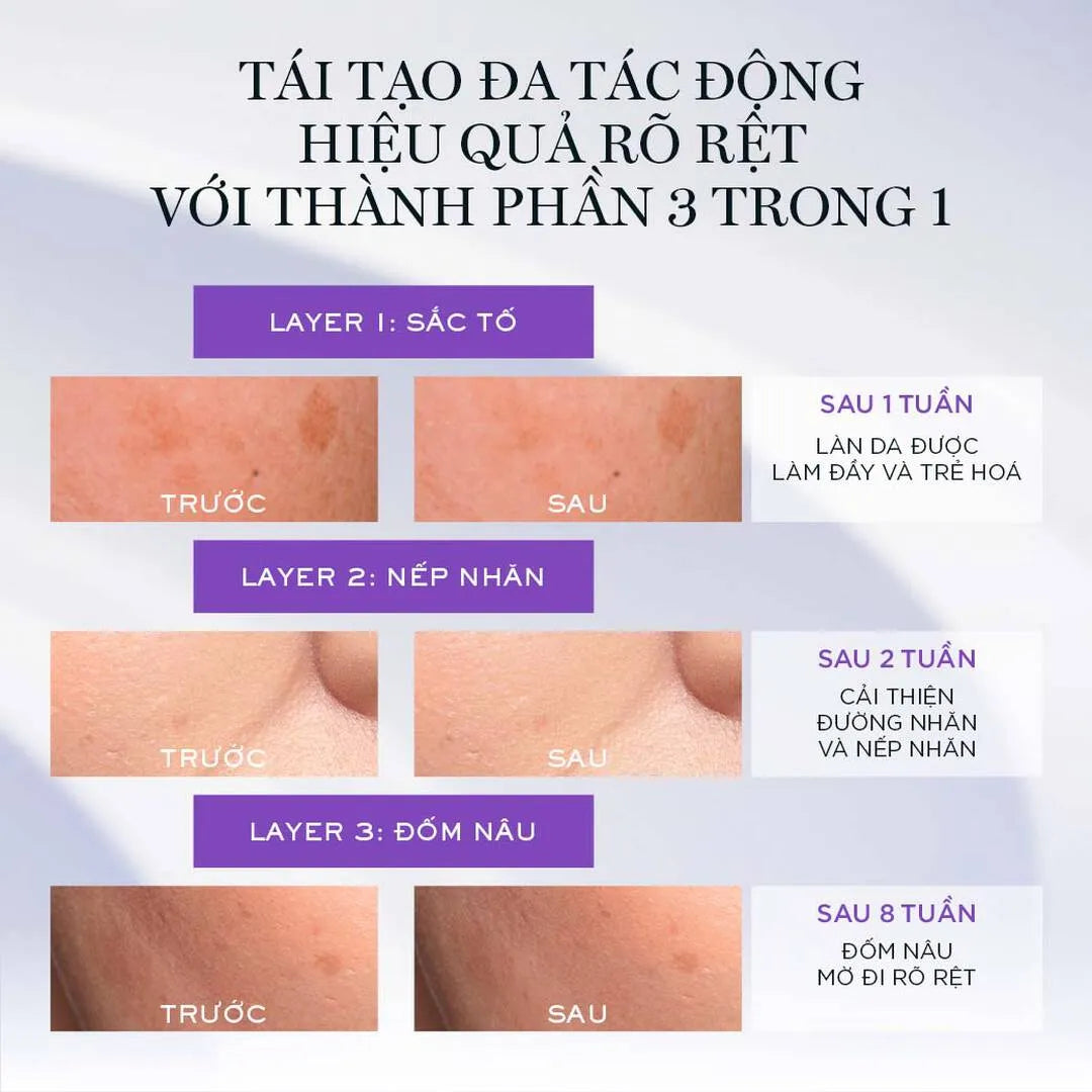Tinh Chất Chống Lão Hóa 3 Lõi Cao Cấp Lancôme Rénergie H.C.F. Triple Serum 50ml (Pháp)