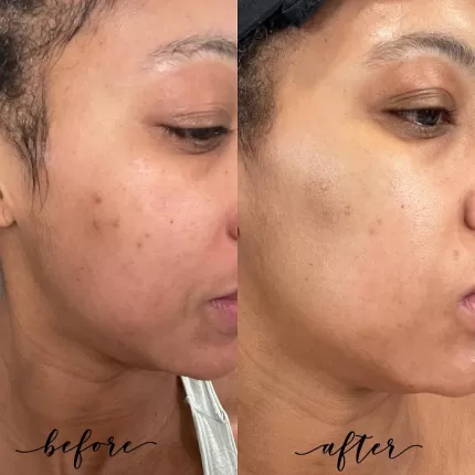 Tinh Chất Trị Nám Trắng Da Image Skincare Iluma Intense Facial Illuminator