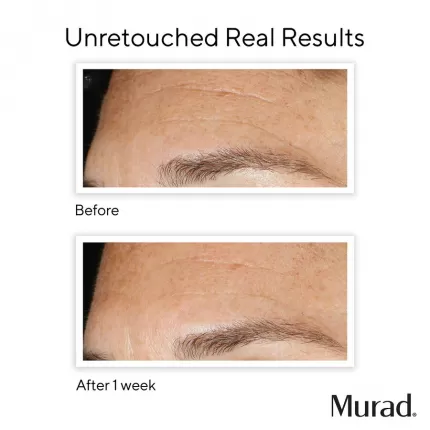 Peel Da Kích Hoạt Thanh Xuân Murad  Replenishing Multi-Acid Peel