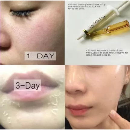 Thay da sinh học BQCell Derma Skin Peeling Hàn Quốc